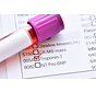 Cardiac Troponin T