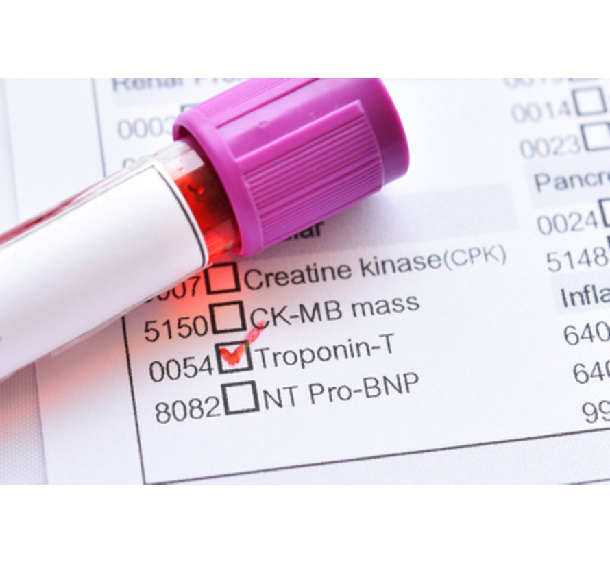 Cardiac Troponin T