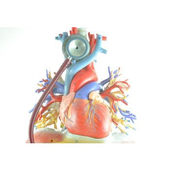 geoxideerd LDL Cholesterol