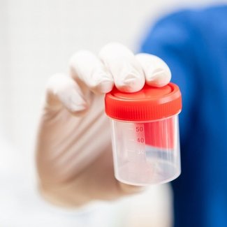 Drugsscreening urine en bloed CBR