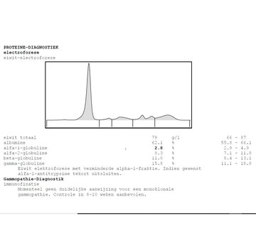 Globulin protein electroferesis