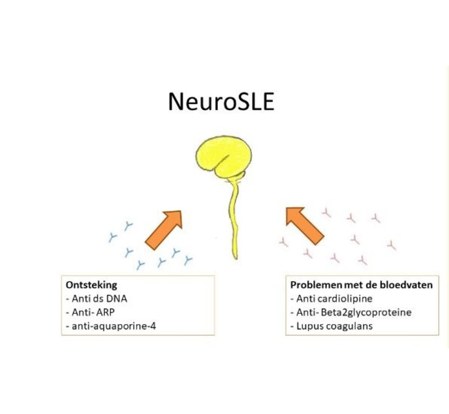 anti-dsDNA antibodies