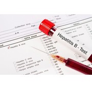 Hepatitis anti-HBc