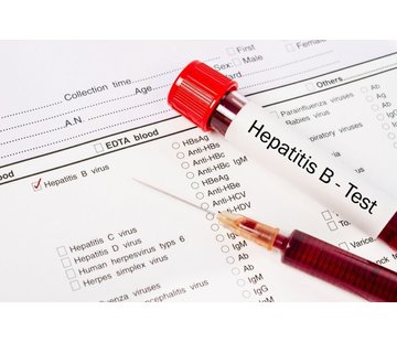 Hepatitis anti-HBc