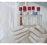 Check-up Basis Bloedonderzoek