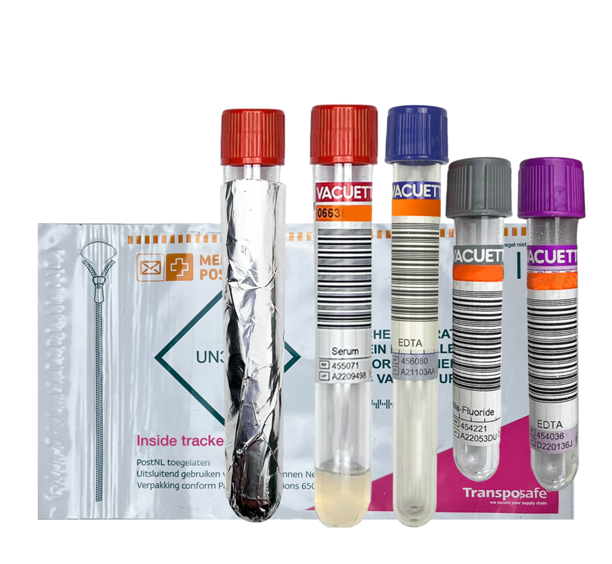 InsideTracker Ultimate Basis  (bloedtest only)