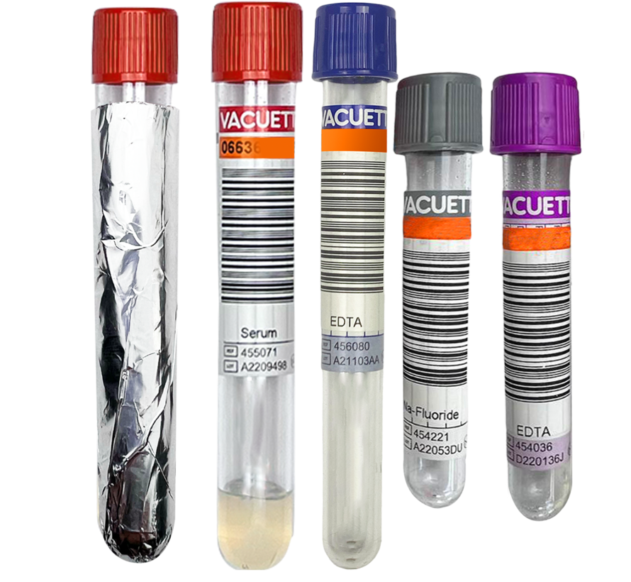 InsideTracker Ultimate Basis  (bloedtest only)