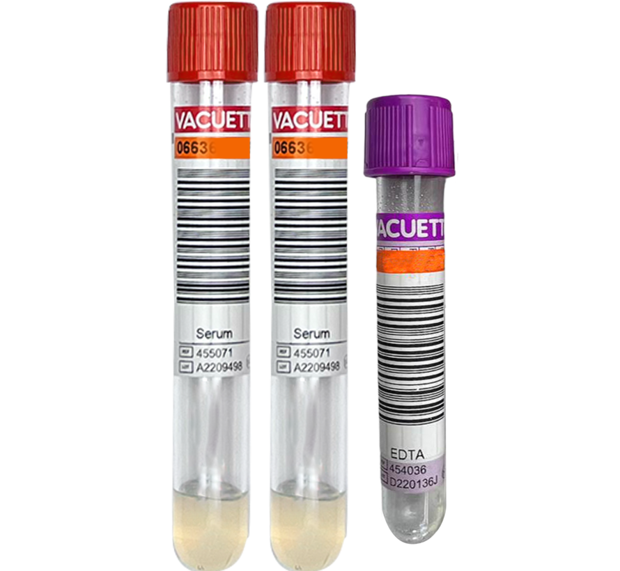 Flex Challenge bloedtest met Oestradiol