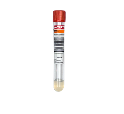 Bloedonderzoek Testosteron (vrij) + SHBG