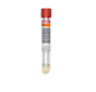 Bloedonderzoek Testosteron (vrij) + SHBG