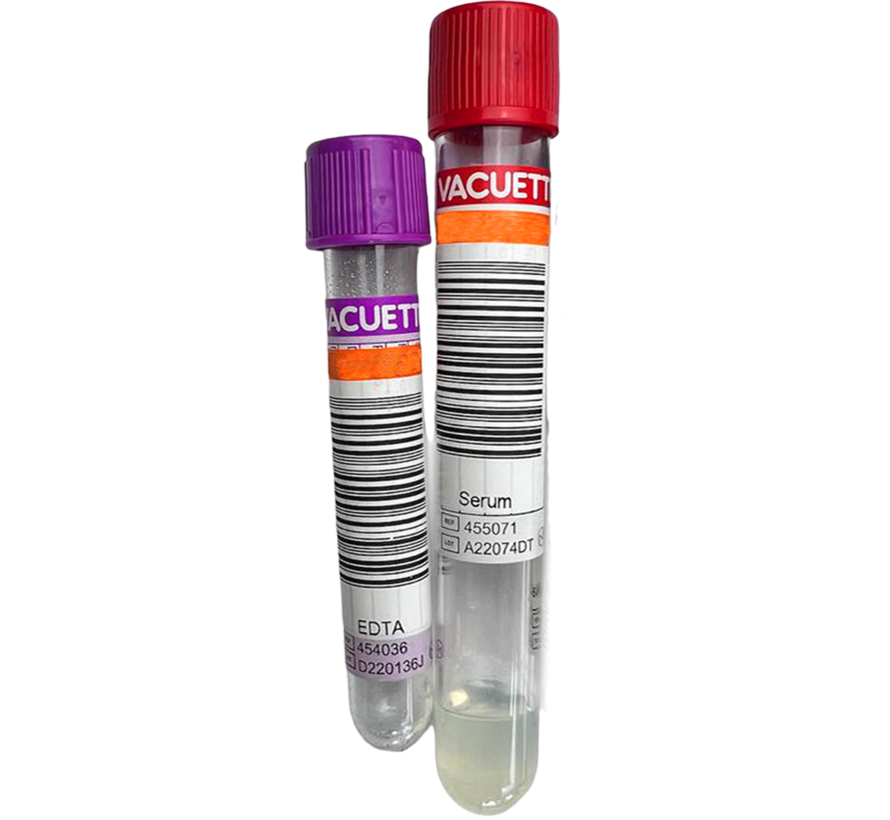 Medical Check-up General blood test