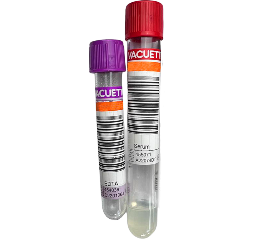 Medische Check-up Algemeen bloedonderzoek