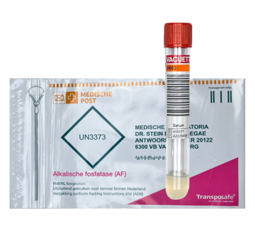 Alkalische fosfatase (AF)