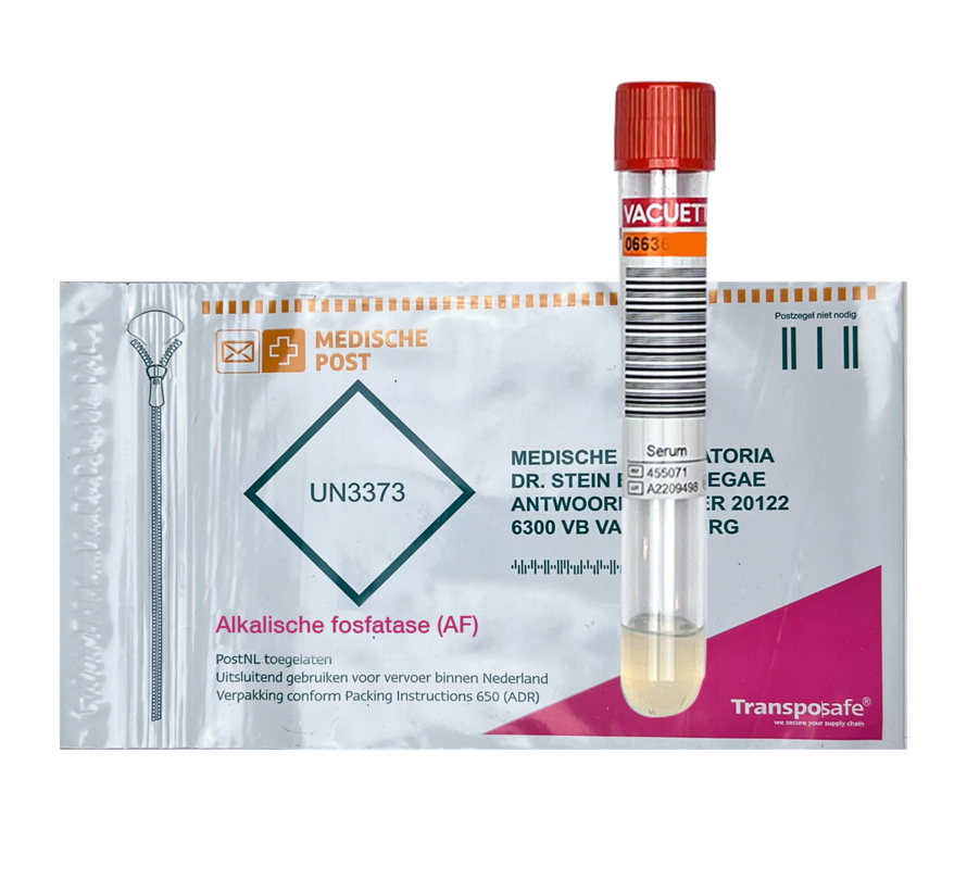 Alkalische fosfatase (AF)