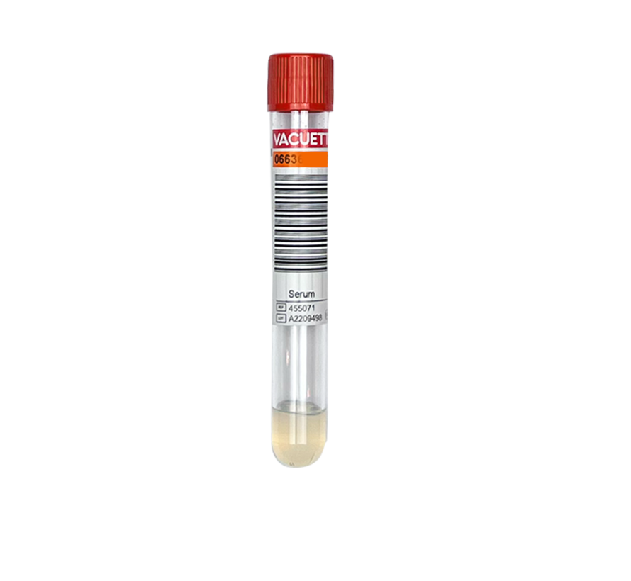 GFR (CK-DEPI-formule) nierfunctie