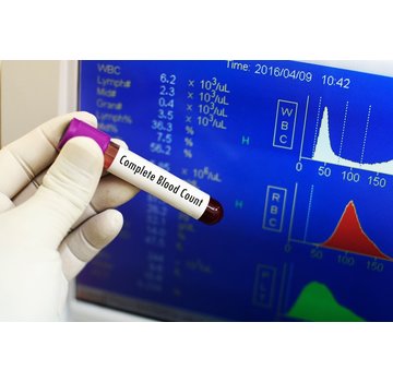 comprehensive blood count with RDW absolute and percentages