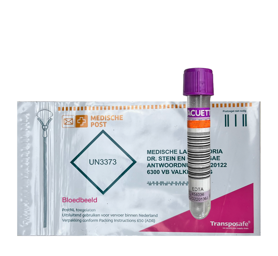 Comprehensive blood count including Leuco Diff and RDW