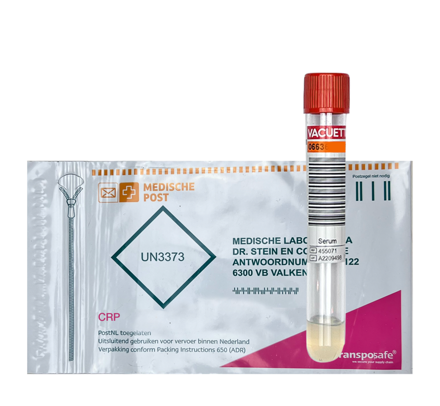 hs-CRP (inflammation or infection ultra sensitive)