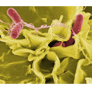 Salmonella antibodies IgA