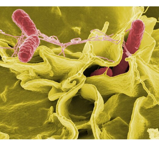 Salmonella IgA bloedonderzoek