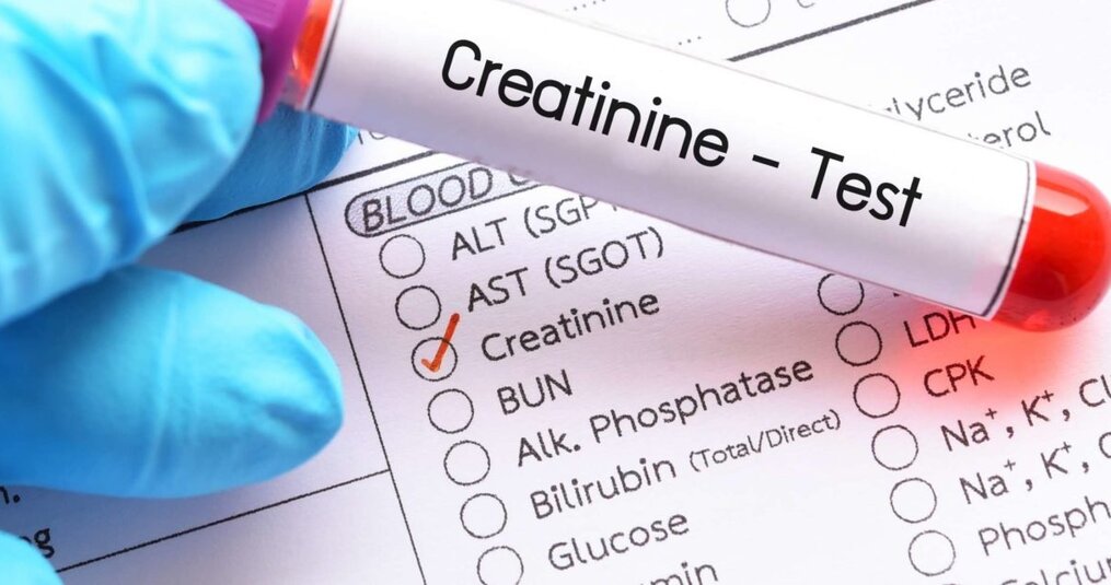 CKD-EPI-formule (Chronic Kidney Disease Epidemiology Collaboration)