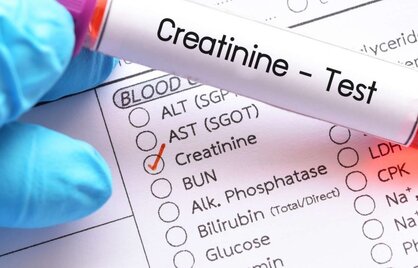 CKD-EPI (Chronic Kidney Disease Epidemiology Collaboration) formula.