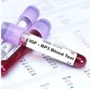 IGF-BP3