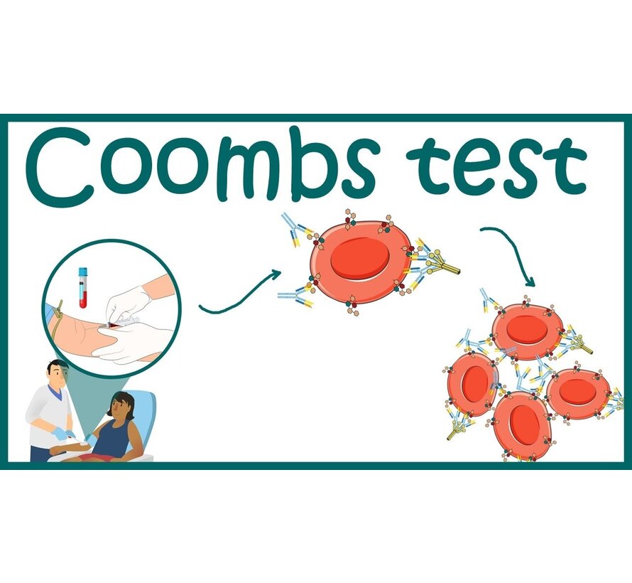 Indirect coomb test