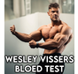 Wesley Vissers' optimal bodybuilding test