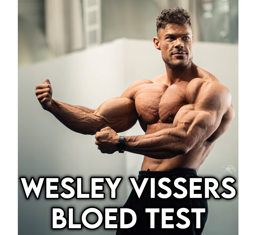 Wesley Vissers' optimal bodybuilding test