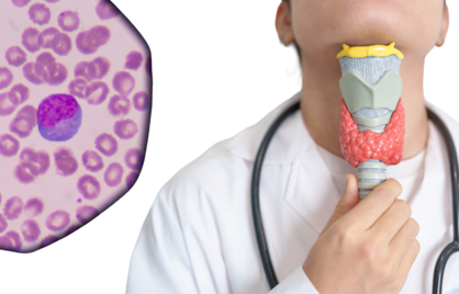 Wat zijn lymfocyten en wat is de normaalwaarde?