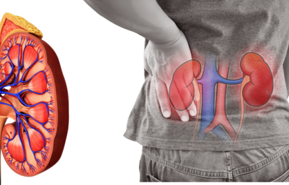 Wat zegt de Albumine/Creatinine ratio?