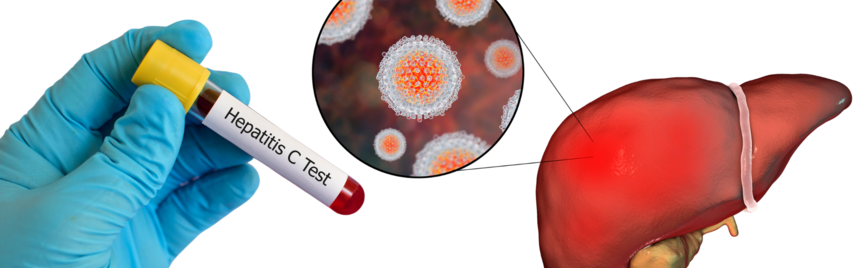 Wat is Hepatitis C, hoe krijg je het en hoe kun je het testen?