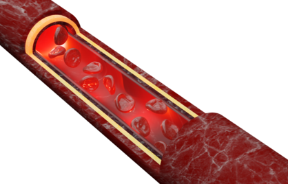 What is RDW value in blood?