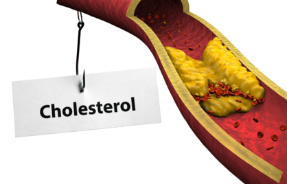 When is your cholesterol too high?