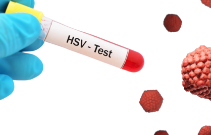 Herpes Simplex Virus (HSV) testen en hun betekenis