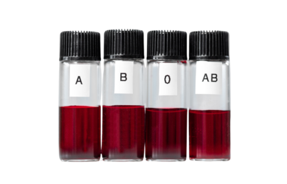 Bloedgroep en Rhesus test: belangrijk voor zwangerschap en reizen