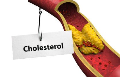 Nieuwe Cholesterolreferentiewaarden per 1 september – Wat je moet weten