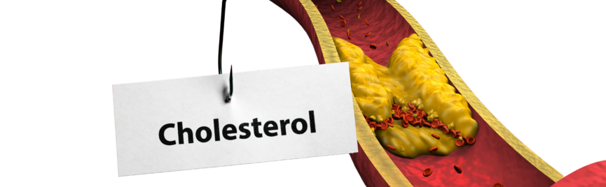 Nieuwe Cholesterolreferentiewaarden per 1 september – Wat je moet weten