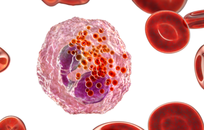 Verhoogde Eosinofielen, normale waarden - Wat het betekent voor je gezondheid