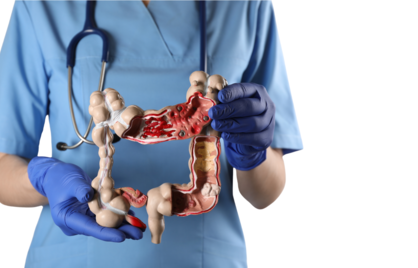 Het Belang van Vroege Opsporing van Dikkedarmkanker: Onderzoek vanaf 50 Jaar en de Rol van Eenvoudige Tests