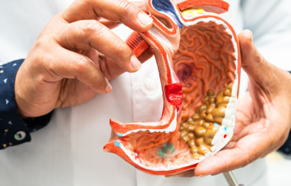 Wat is een Normale Calprotectinewaarde? Uitleg bij Ziekte van Crohn