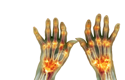 Wat Is de Normale BSE Waarde? Overzicht van Bezinkingstest Resultaten