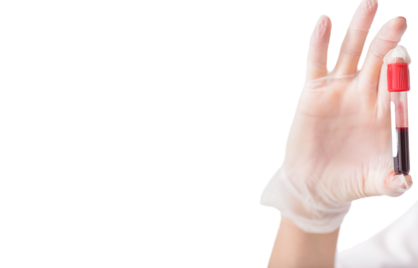 Alles over prolactine: wat is het en wat zijn de normaalwaarden?