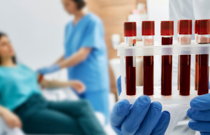 Bloedonderzoek zonder verwijzing: kosten, vergoeding en mogelijkheden