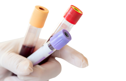 Jaarlijks Bloedonderzoek: Wat wordt Gecontroleerd en wordt het vergoed?