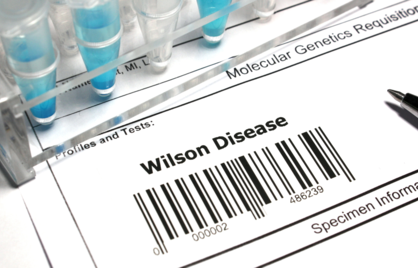 De ziekte van Wilson: oorzaken, symptomen, diagnose en behandeling