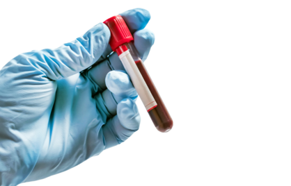 7 redenen waarom regelmatig bloedtesten jouw gezondheid kan transformeren