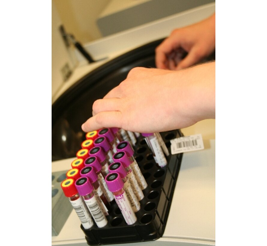 Expat Health Clinic | Diabetes Screening Panel