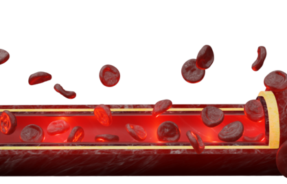 Te weinig bloedplaatjes? Het verschil tussen trombocytopenie en hemofilie